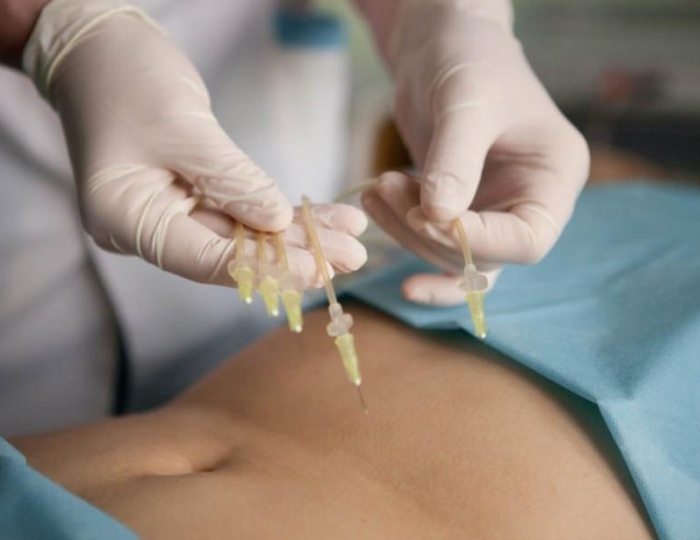 Озонотерапия - Оздоровительные услуги - Санаторий «Юность» Беларусь